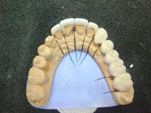 odontoiatra cassino il tuo dentista pic 1